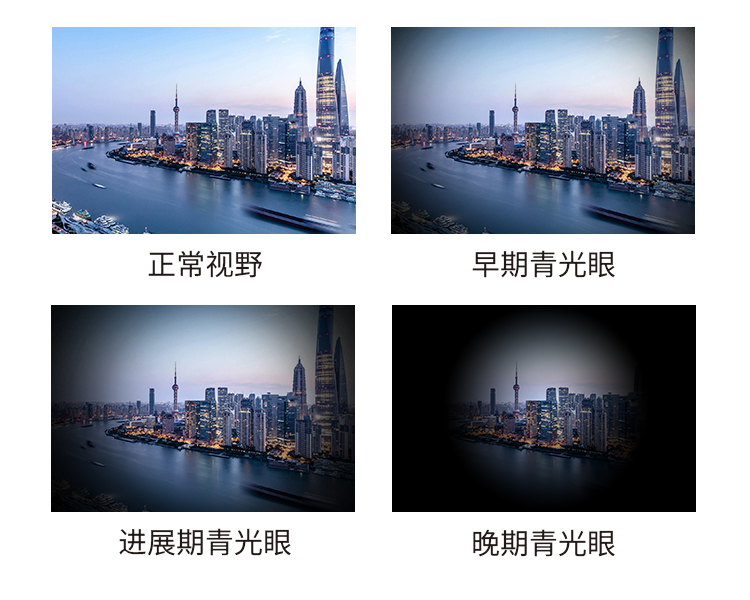 青光眼進展圖片.jpg
