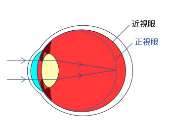 愛眼日如期而至，關注孩子眼睛健康，讓他們擁有一個光明未來！