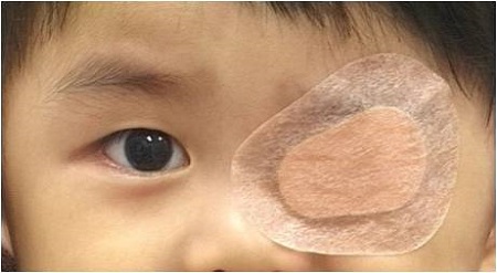 孩子看東西老喜歡斜著眼，“打一頓”就能好嗎？
