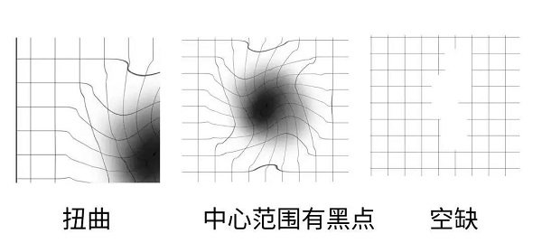 什么是黃斑變性？
