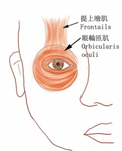 眼瞼痙攣