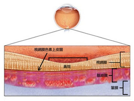 中漿危及視力