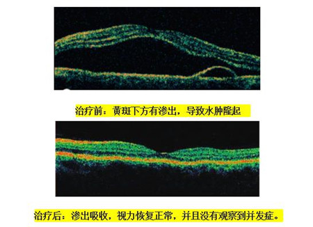 中漿如何治療