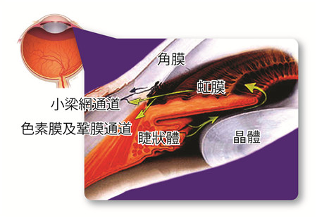青光眼患者應該積極治療