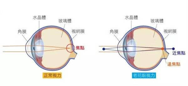 近視就不會患上老花眼?近視的你別等老花找上門才了解真相!