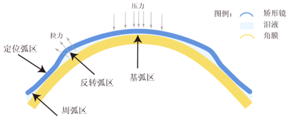 怕孩子度數(shù)猛增？除了開啟APP青少年模式，還有一招可控制！