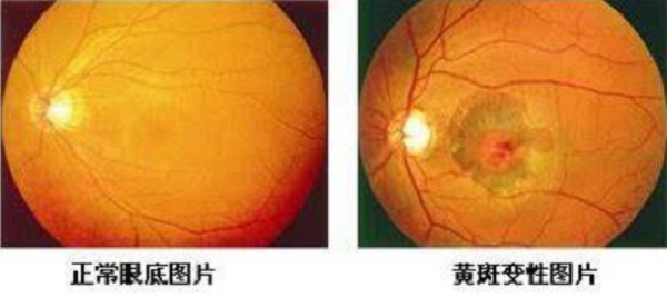 這個(gè)夏天對(duì)眼部防曬還沒(méi)重視起來(lái)?小心這4種病癥找上你!