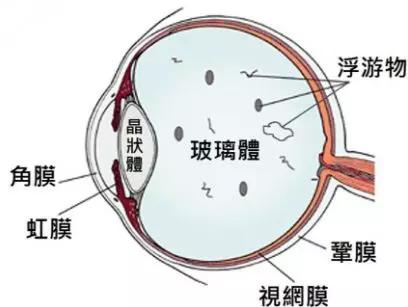 你真的了解視網膜嗎？如果視網膜脫落可以這樣治療！