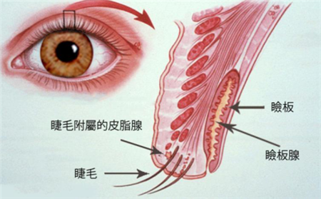 眼瞼皮脂腺