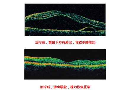 中漿治療