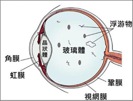 玻璃體視網膜