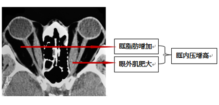 北京甲狀腺治療