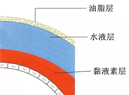 干眼癥是什么原因引起的